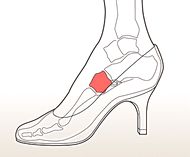 インソールによる効果、足への負担軽減の説明図